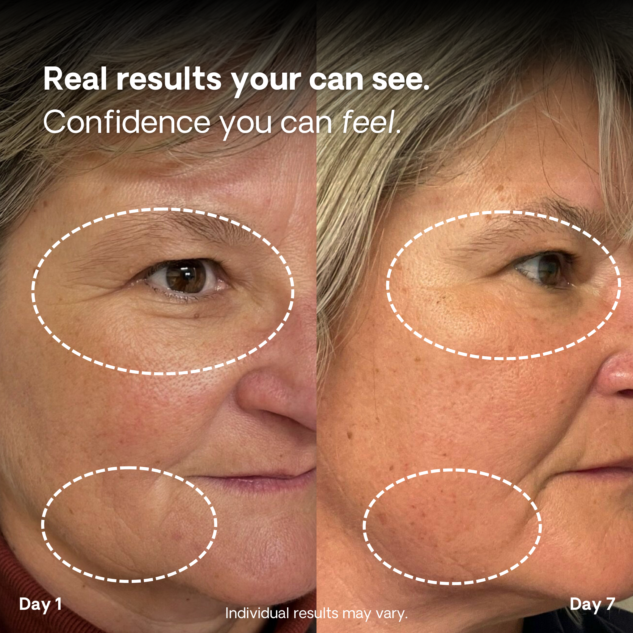 Spectrum SOLO Panel 2.0