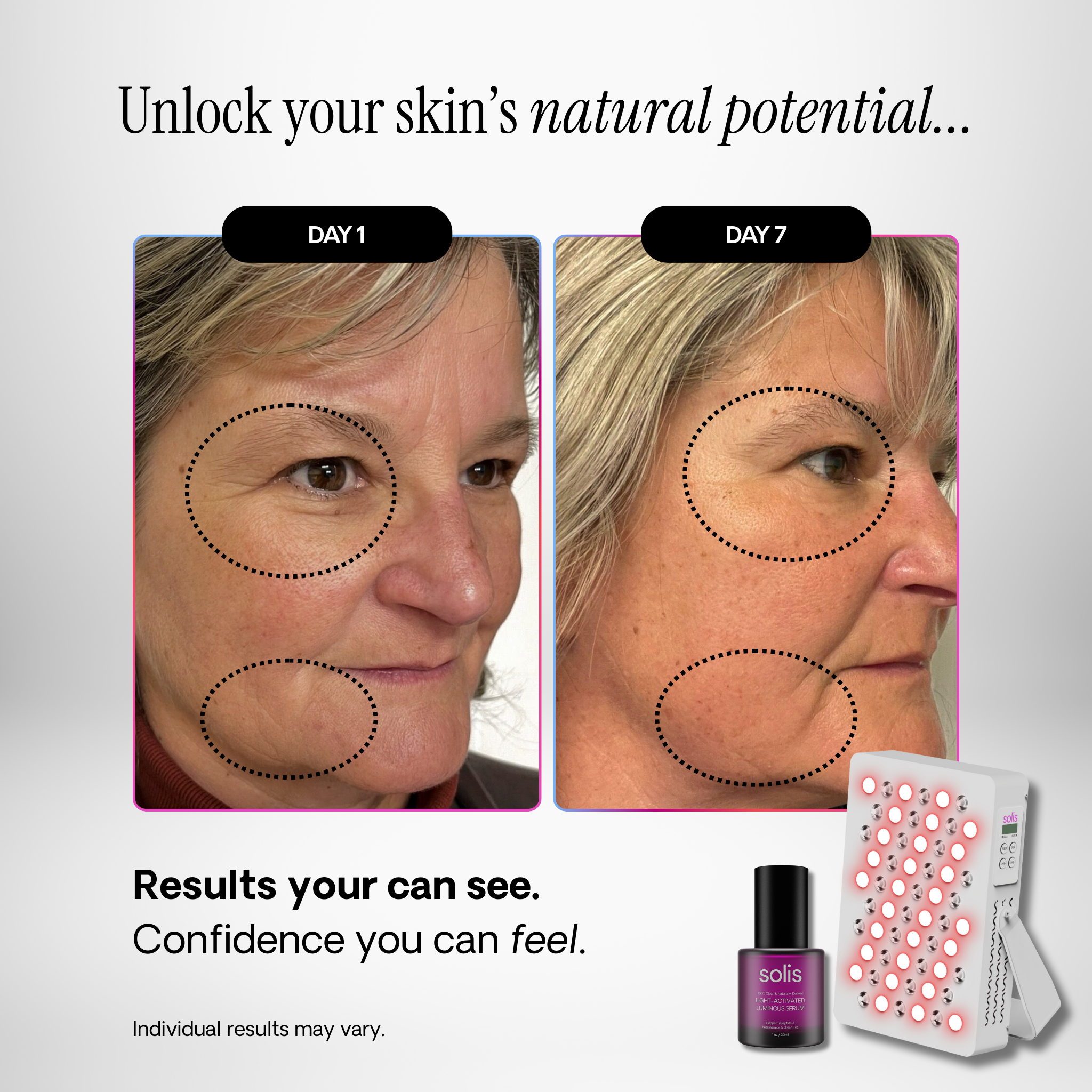 SOLO 2.0 Serum Stack