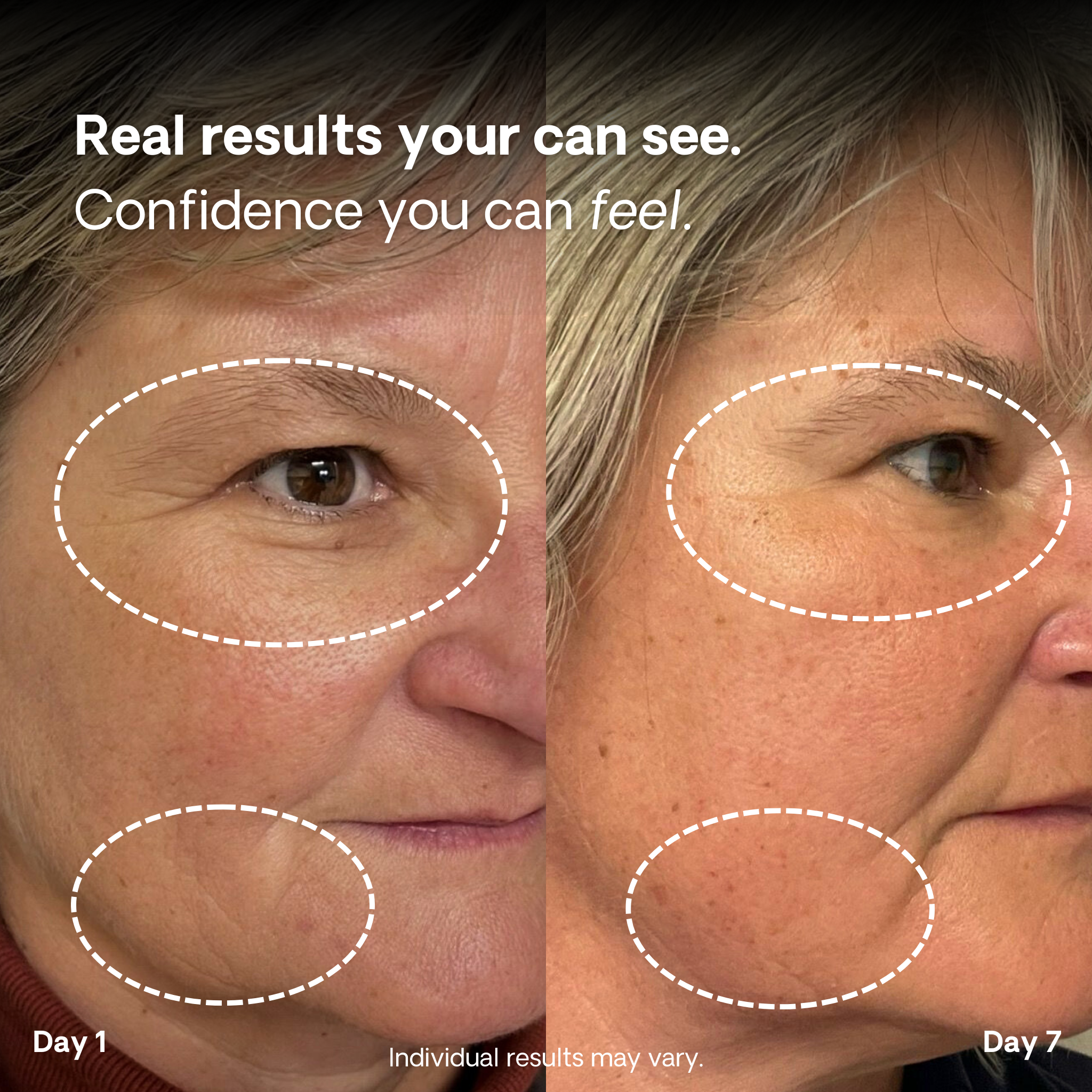 Spectrum SURGE Panel 2.0